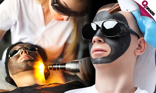 Carbon Laser Facial Treatment for Ladies & Men!